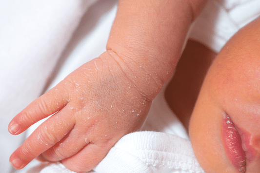 Wie man die Haut eines Babys pflegt